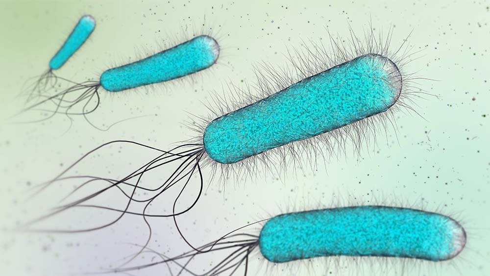 E. coli with flagella.